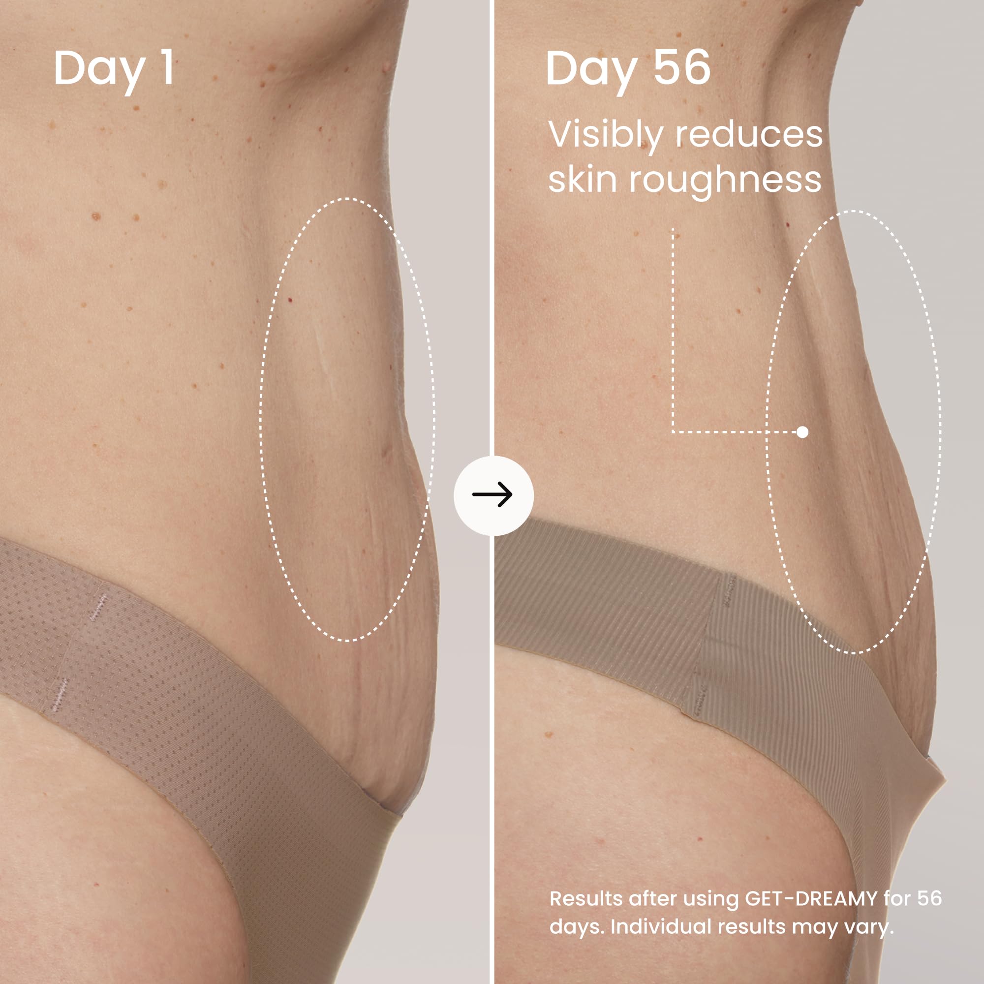 MAËLYS used on legs at night to help improve skin texture
