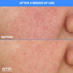 MAMONDE blue chamomile azulene ingredient shot indicating gentle soothing