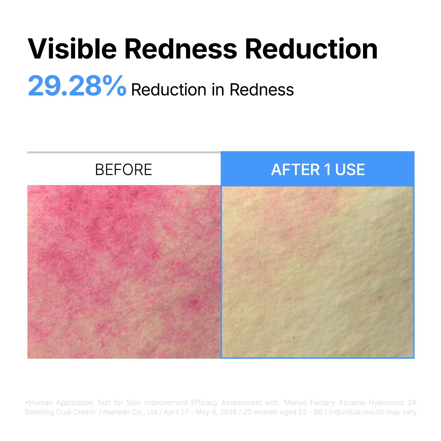 ma:nyo cream being applied to cheek to reduce redness and soothe
