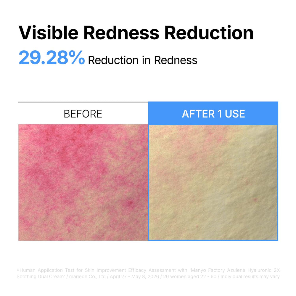ma:nyo cream being applied to cheek to reduce redness and soothe
