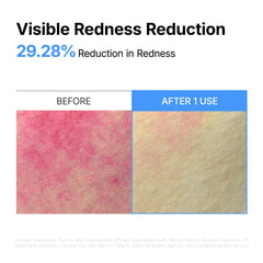 ma:nyo cream being applied to cheek to reduce redness and soothe