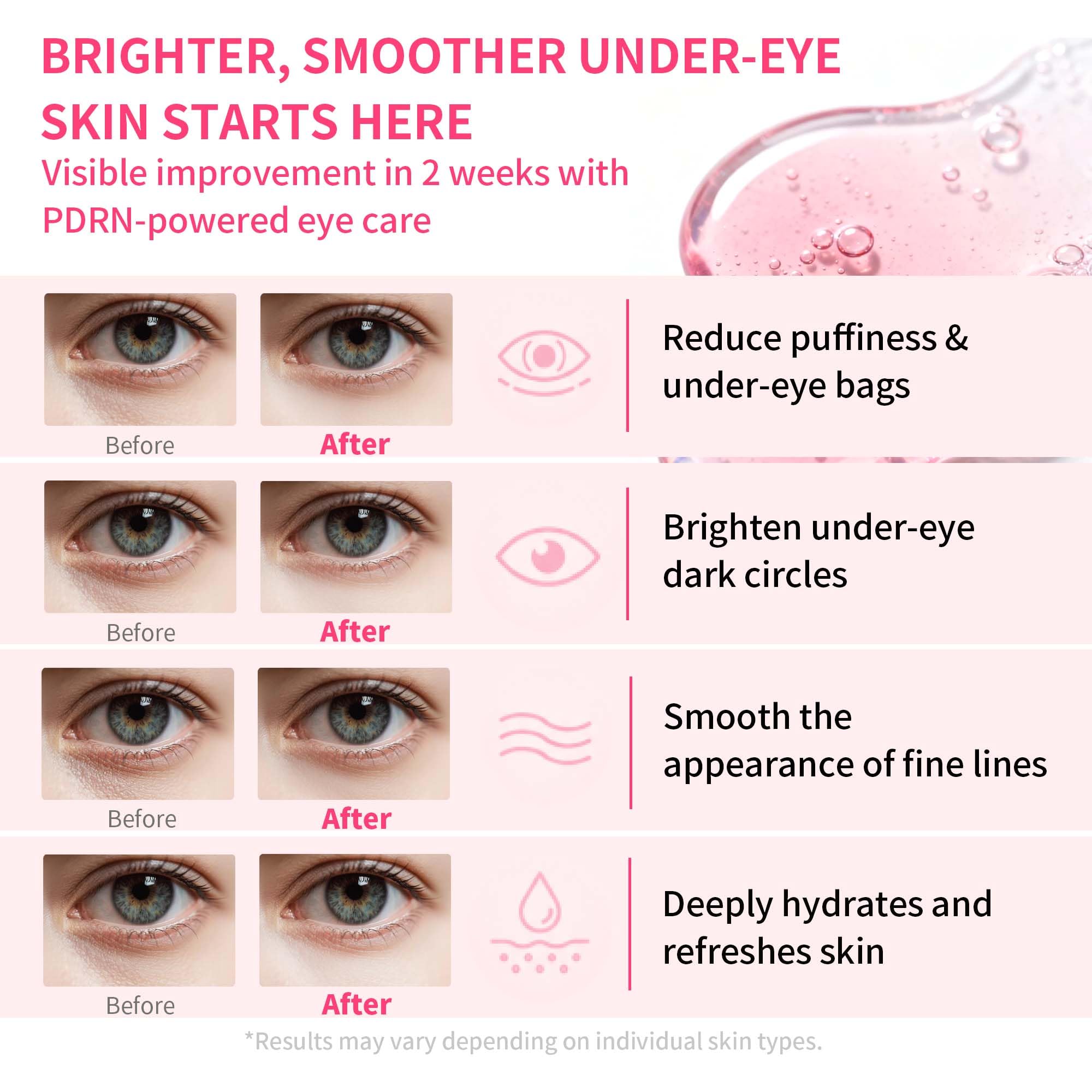 Maskiss serum droplet on patch highlighting hydration boost