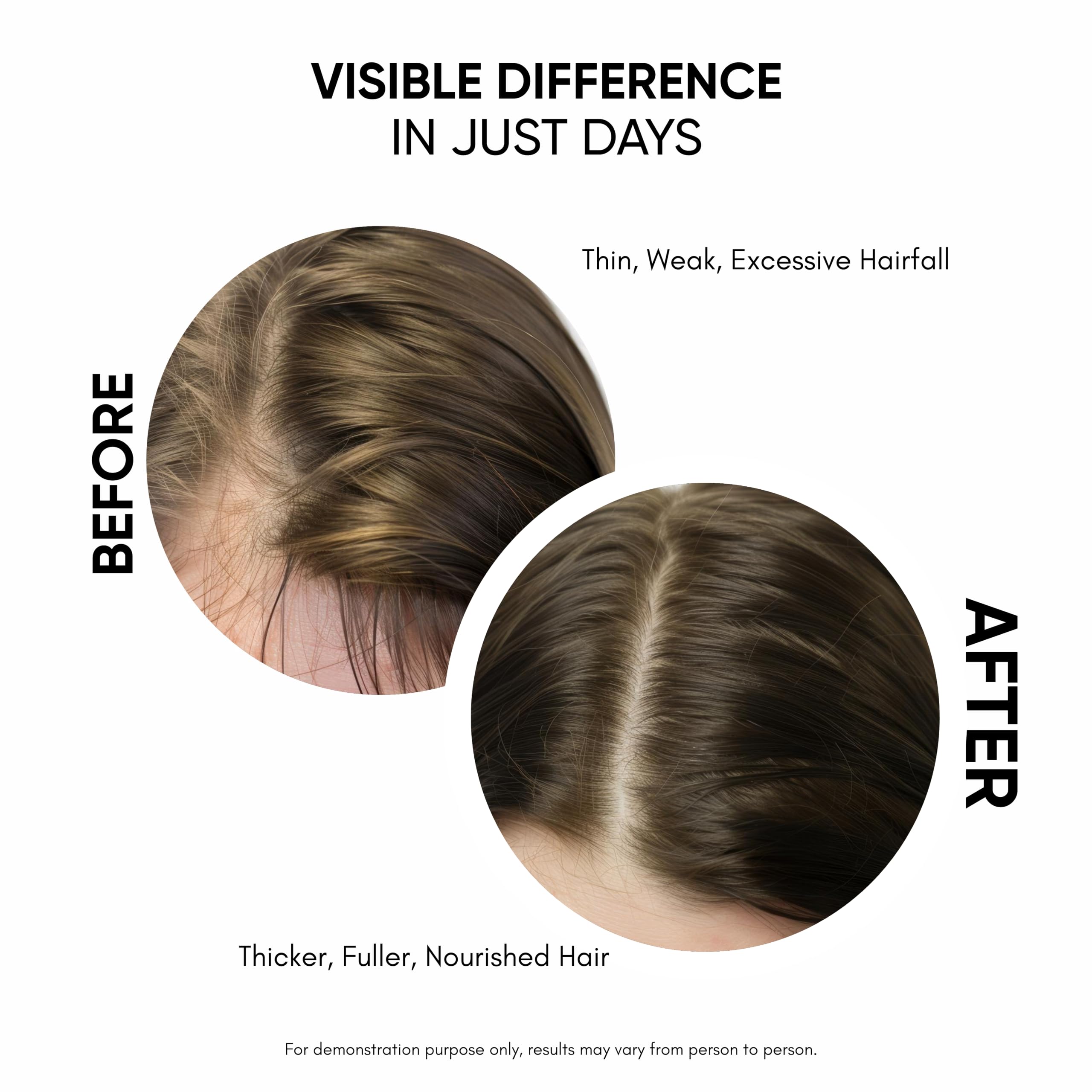 Applying Masofta to scalp demonstrating massage for improved absorption