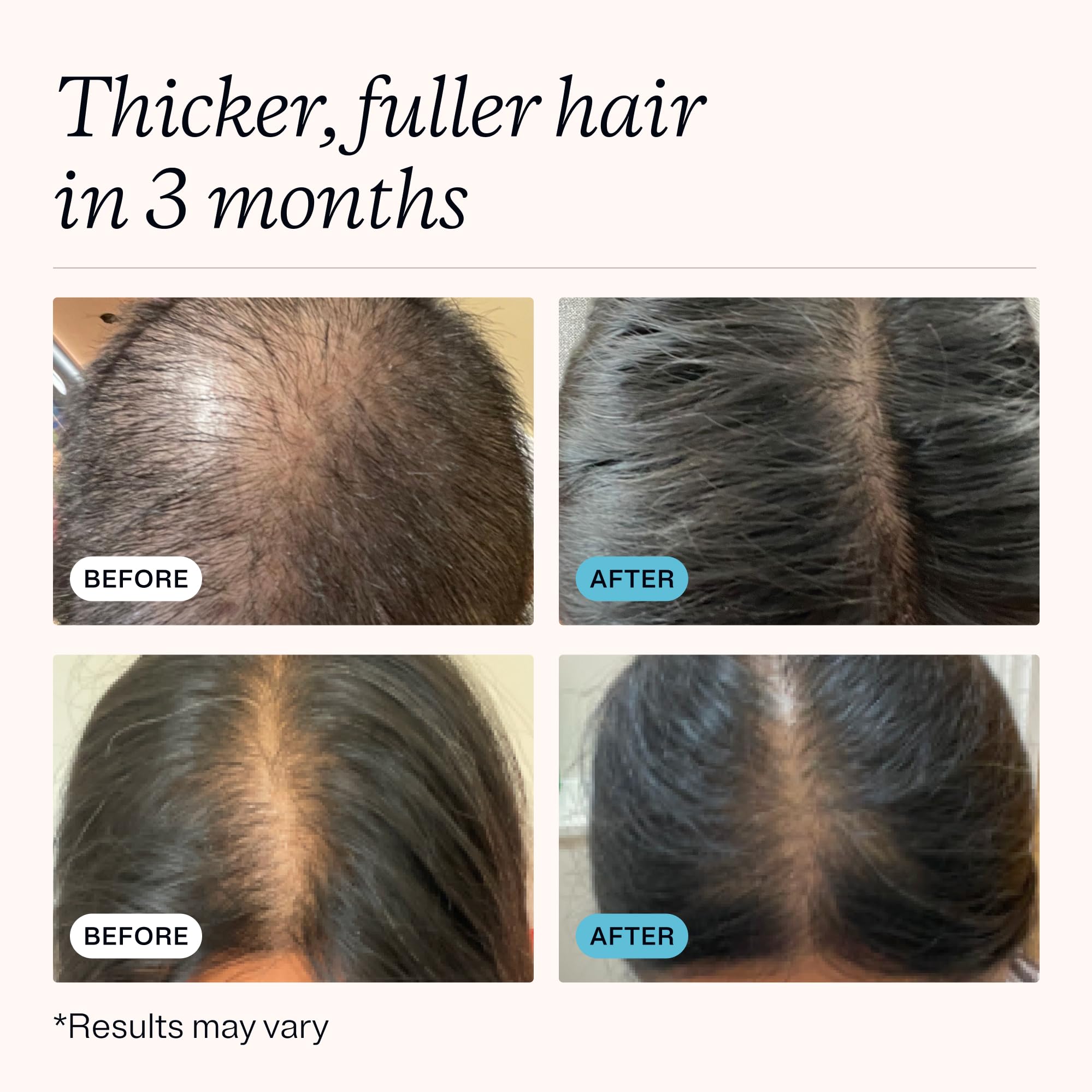 MDhair active ingredients label visible with biotin iron zinc benefits