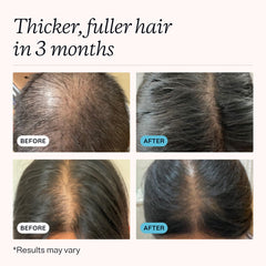 MDhair active ingredients label visible with biotin iron zinc benefits