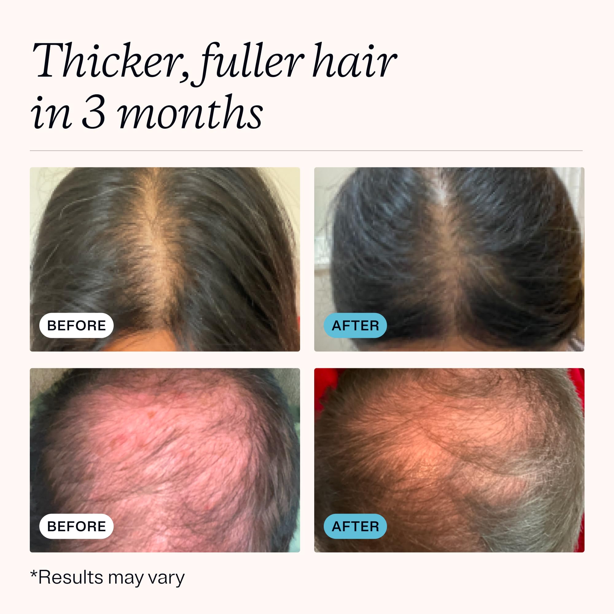 MDhair creamy lather texture demonstrating gentle cleansing