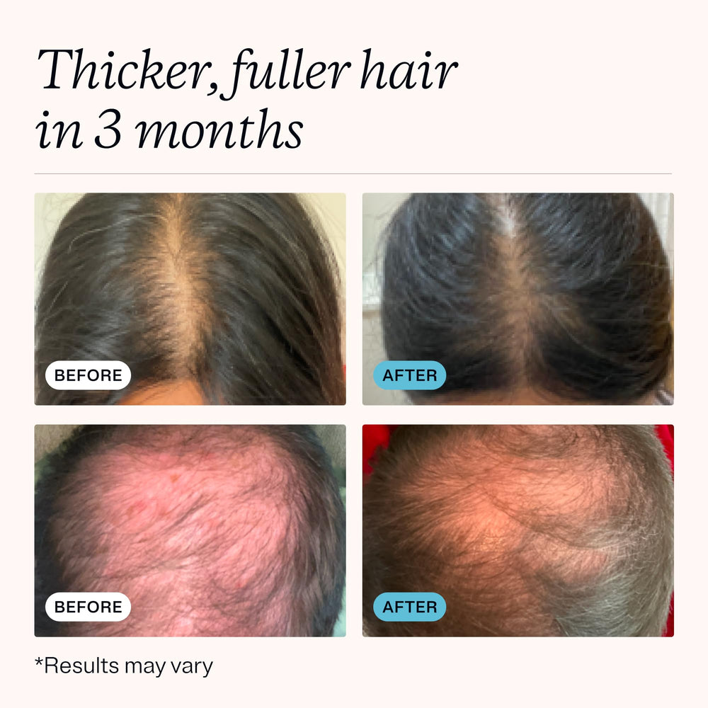 MDhair creamy lather texture demonstrating gentle cleansing