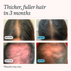 MDhair creamy lather texture demonstrating gentle cleansing