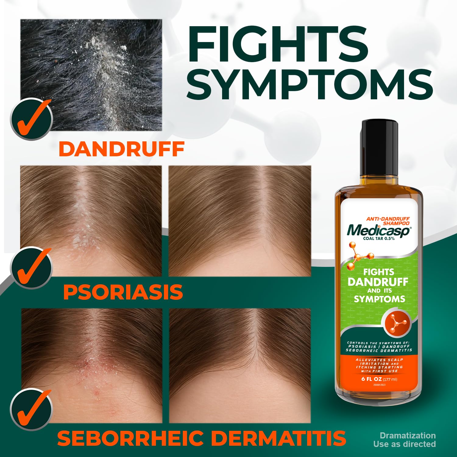 Hands applying Medicasp coal tar shampoo illustrating gentle massage for scalp relief