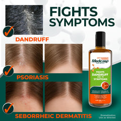 Hands applying Medicasp coal tar shampoo illustrating gentle massage for scalp relief