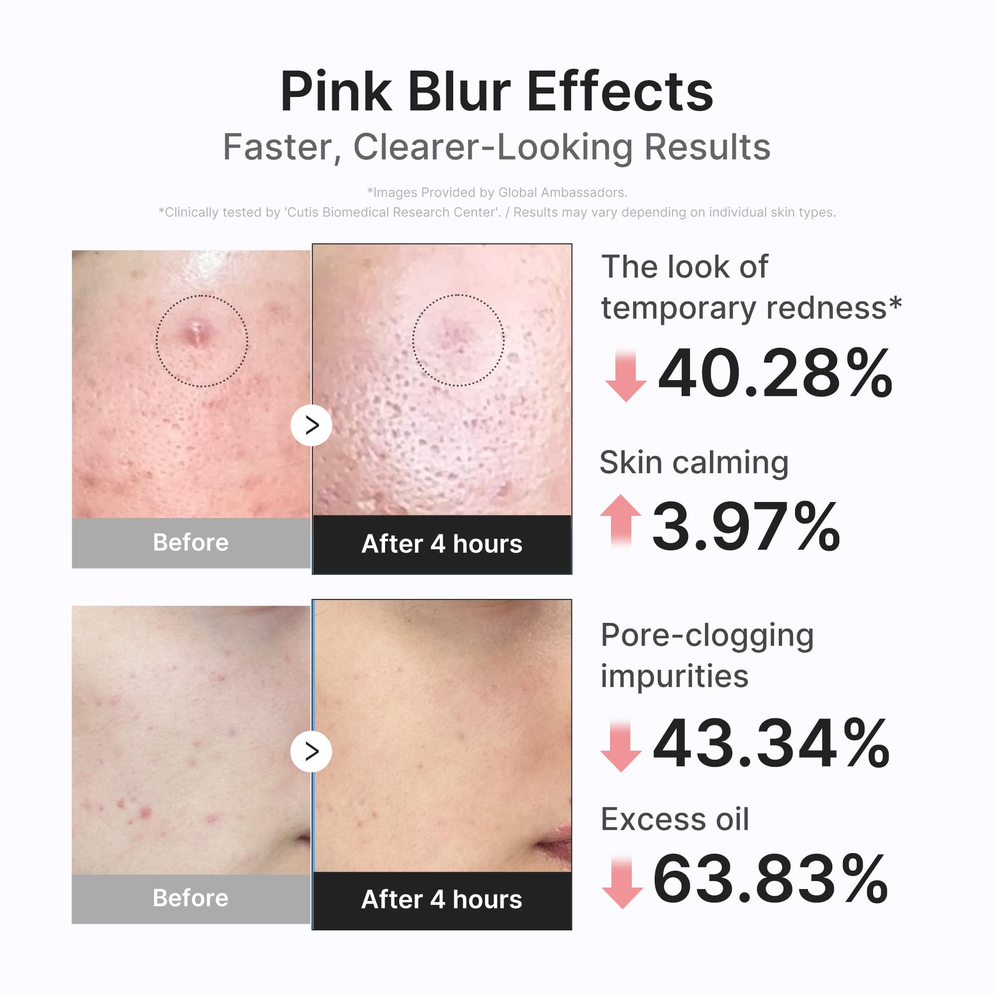 before and after morning result with medicube showing calmer skin