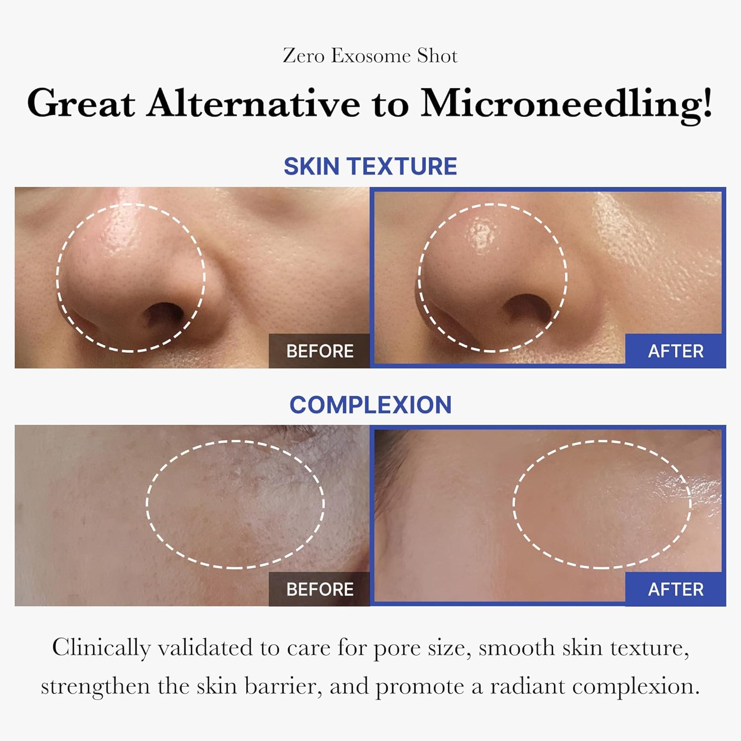 medicube ampoule drop on fingertip ready to apply for precise dosing