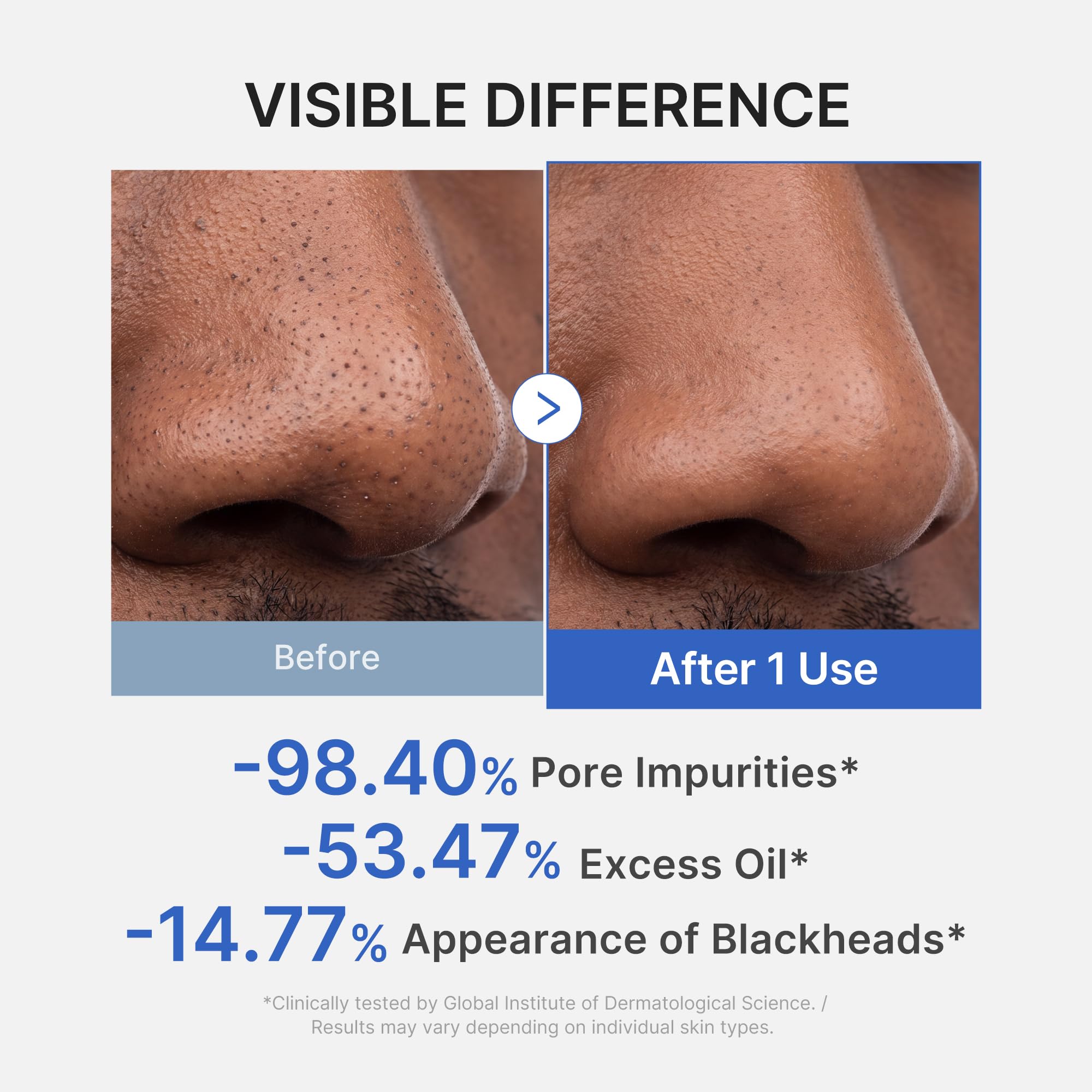 medicube spread on cheek demonstrating quick application and cooling