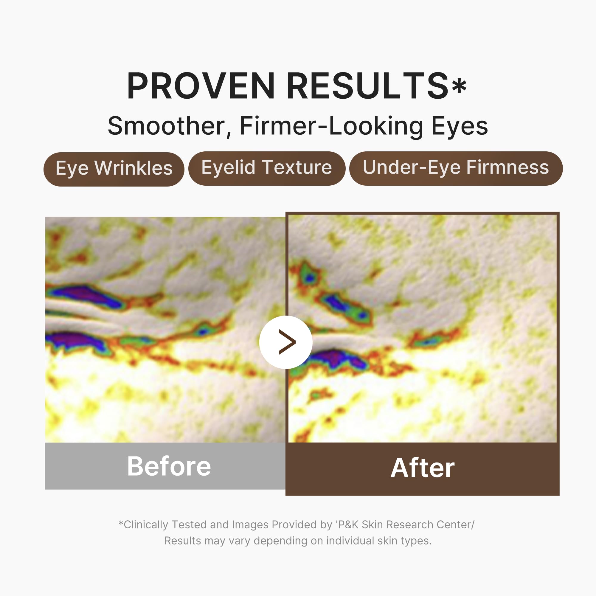medicube application at eye area being gently patted, improves appearance of puffiness
