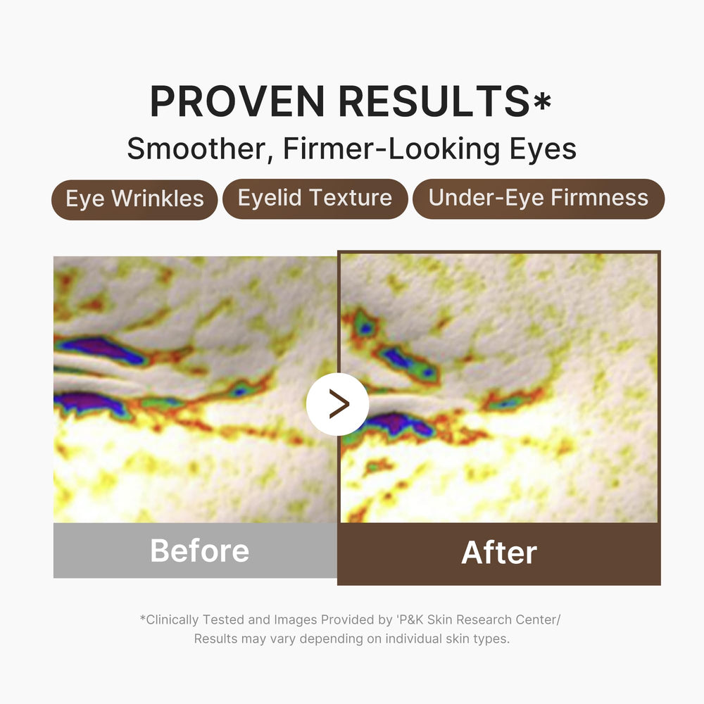 medicube application at eye area being gently patted, improves appearance of puffiness