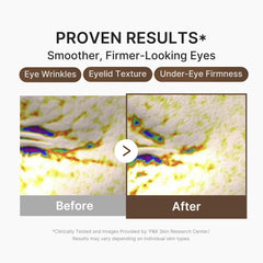 medicube application at eye area being gently patted, improves appearance of puffiness