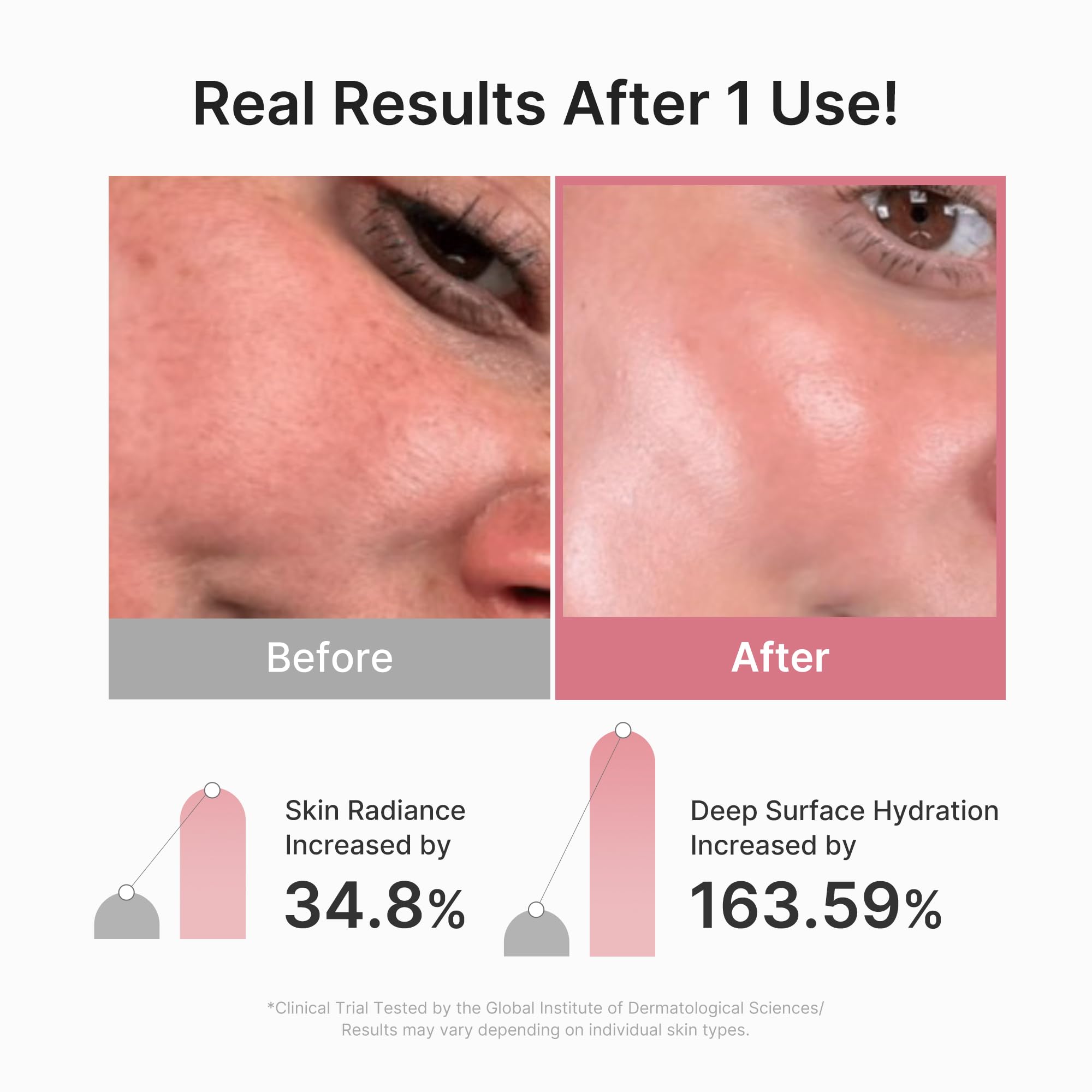 medicube side profile of mask on skin demonstrating edge adhesion and comfort