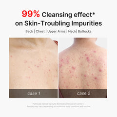 medicube soft lather on skin demonstrating gentle foaming action