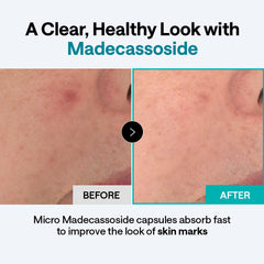 MEDIHEAL ingredient label highlighting madecassoside and niacinamide benefits