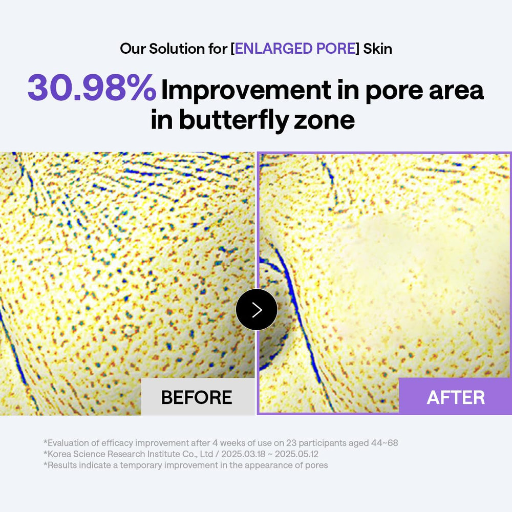 MEDIHEAL pad applied to cheek targeting mid-face lift and pore care