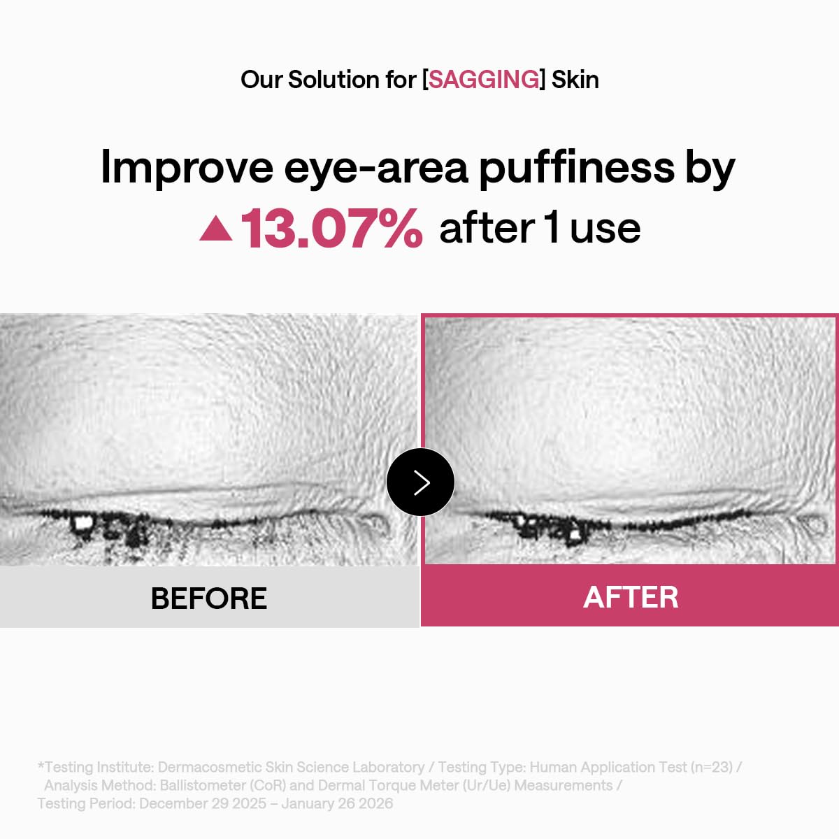 MEDIHEAL patch on smile line illustrating multi-zone coverage and smoothing effect