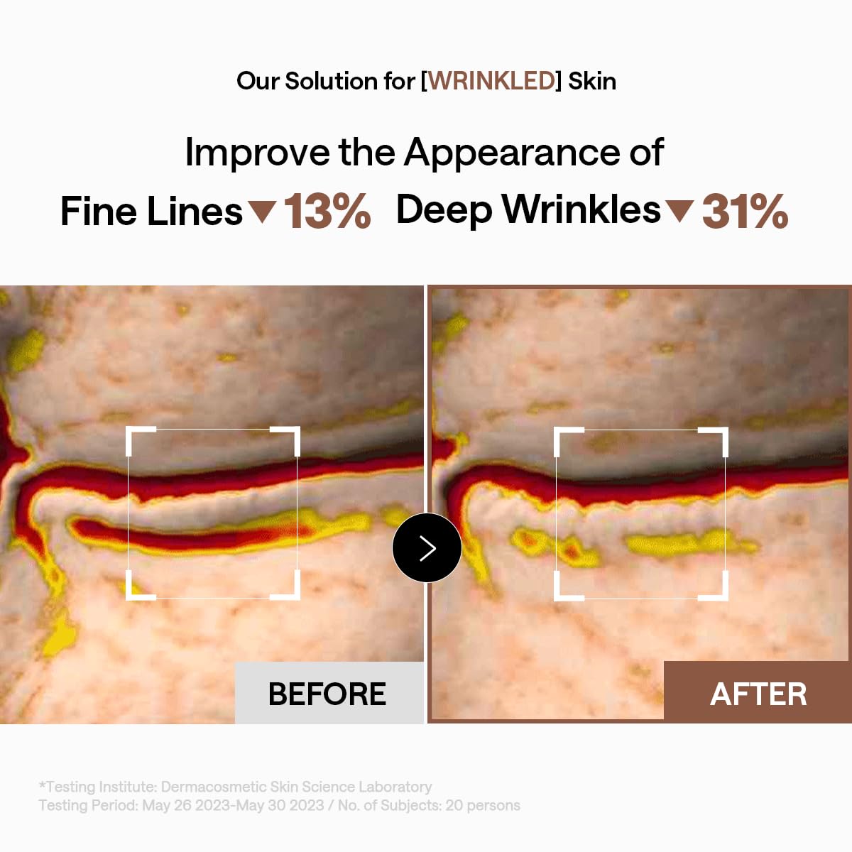 MEDIHEAL patch on forehead showing placement for horizontal line treatment