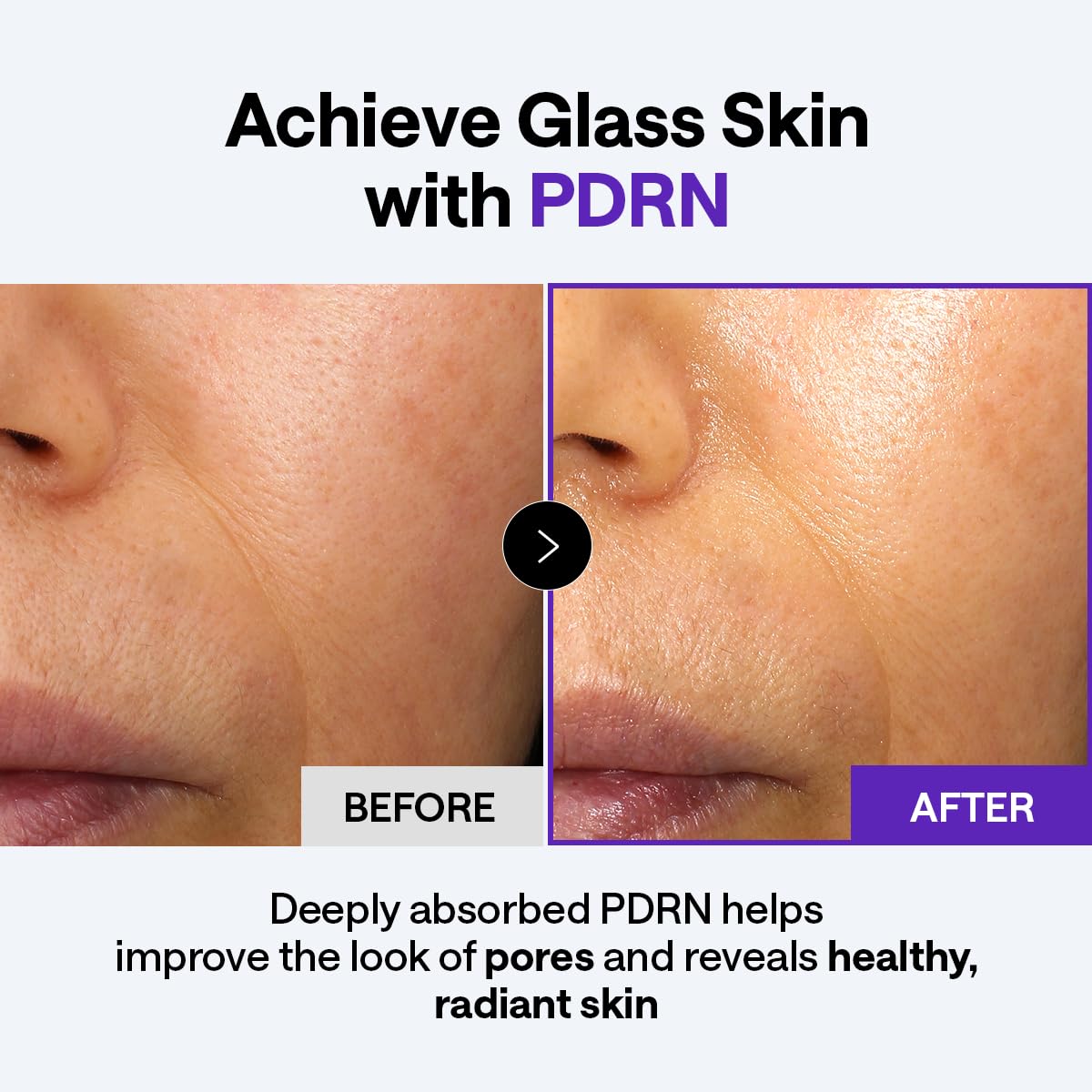 MEDIHEAL applying cream on hand to demonstrate lightweight hydration and spreadability