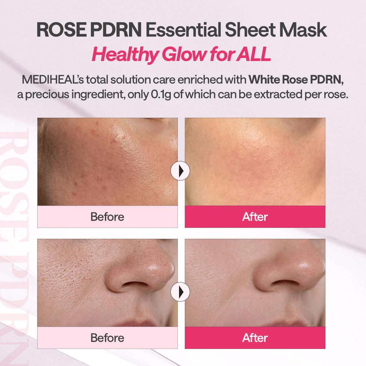 MEDIHEAL serum droplet from vial, highlights concentrated Rose PDRN absorption benefit
