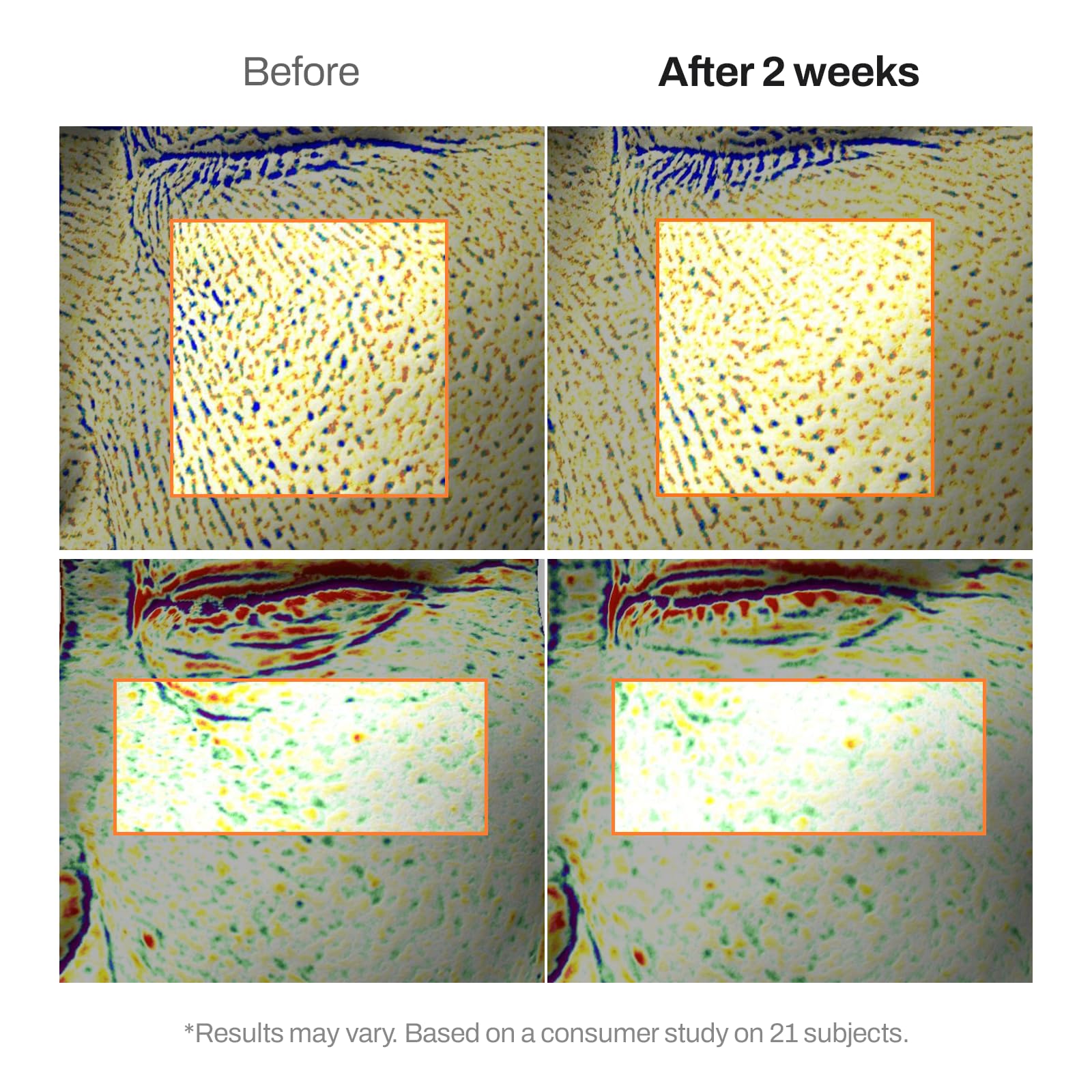 MEDITHERAPY applying cream to neck and face, shows targeted smoothing benefit