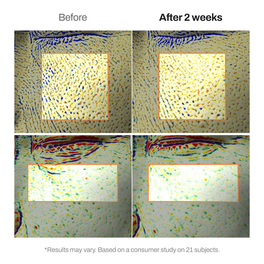 MEDITHERAPY applying cream to neck and face, shows targeted smoothing benefit