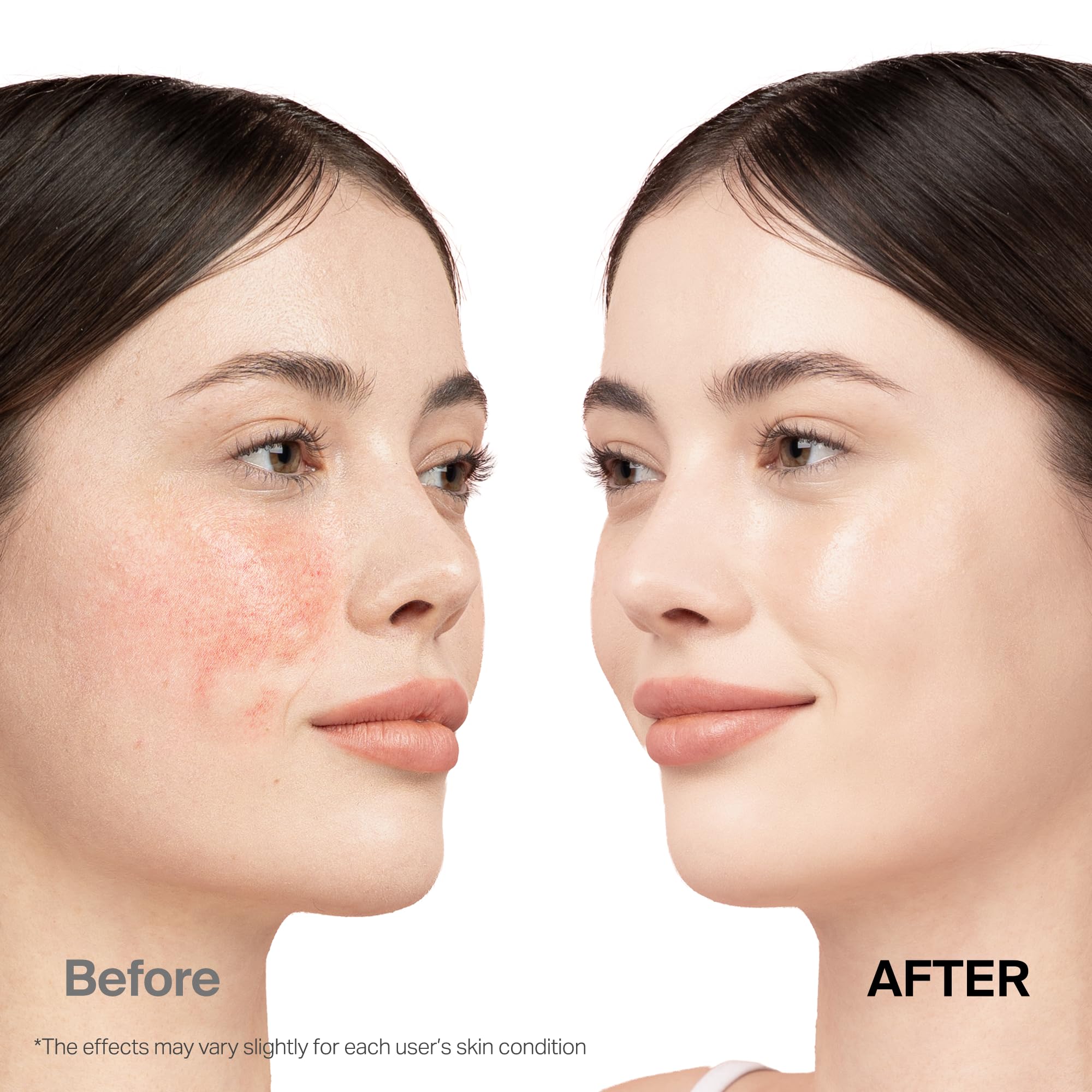 Meebak before-and-after split face demonstrating redness reduction benefit