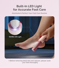 MelodySusie LED light in use illuminating callus area for precise and safer filing