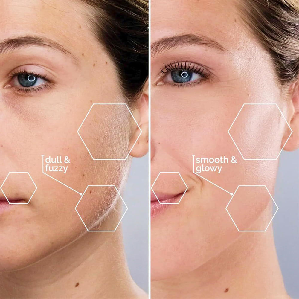 MICHAEL TODD before and after skin texture comparison illustrating smoother finish