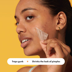 Mighty Patch applied to forehead demonstrating coverage of multiple blemishes and overnight convenience