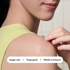 Back of perforated sheet packing showing ten easy-peel Mighty Patch strips