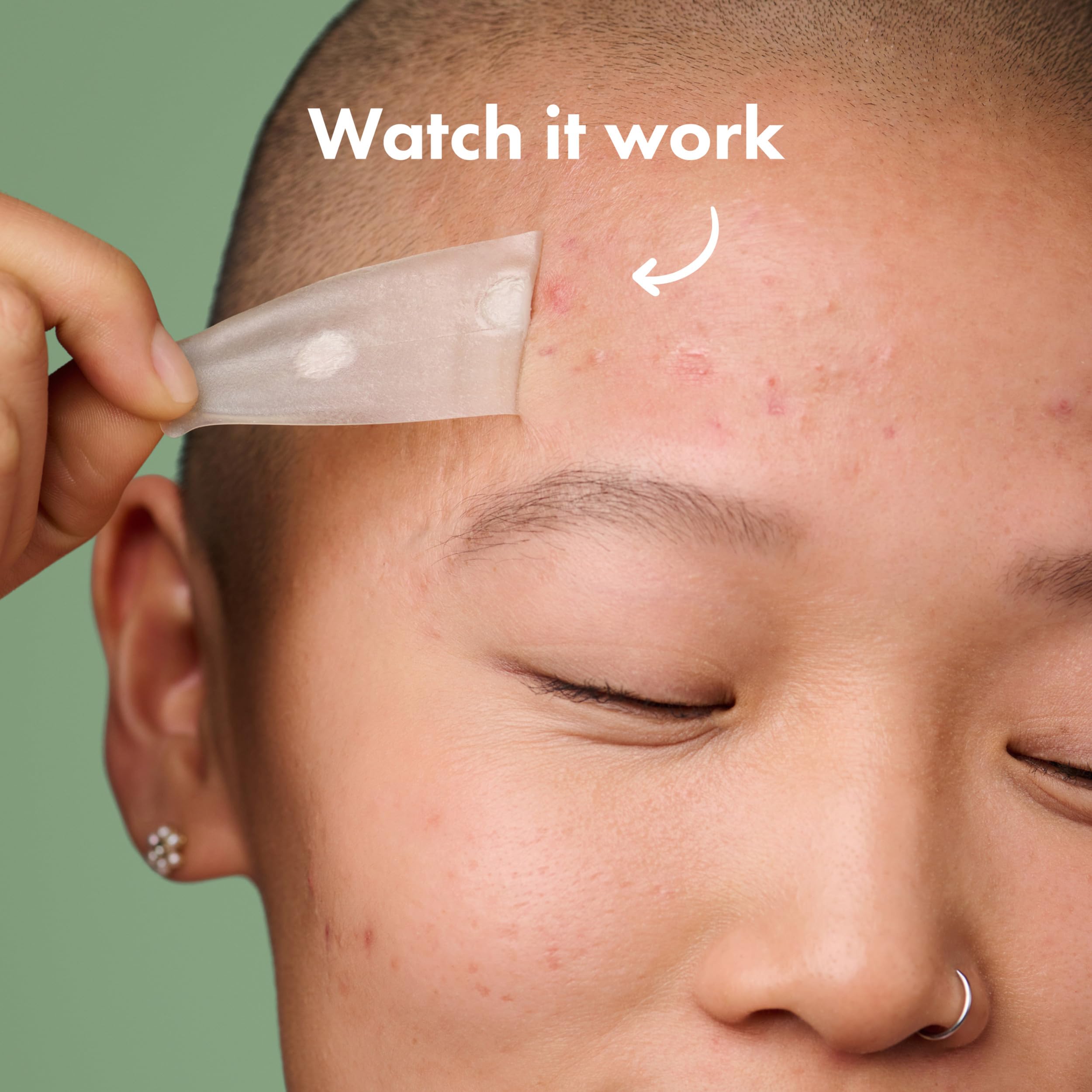 Mighty Patch applied to jawline demonstrating secure coverage and discreet wear