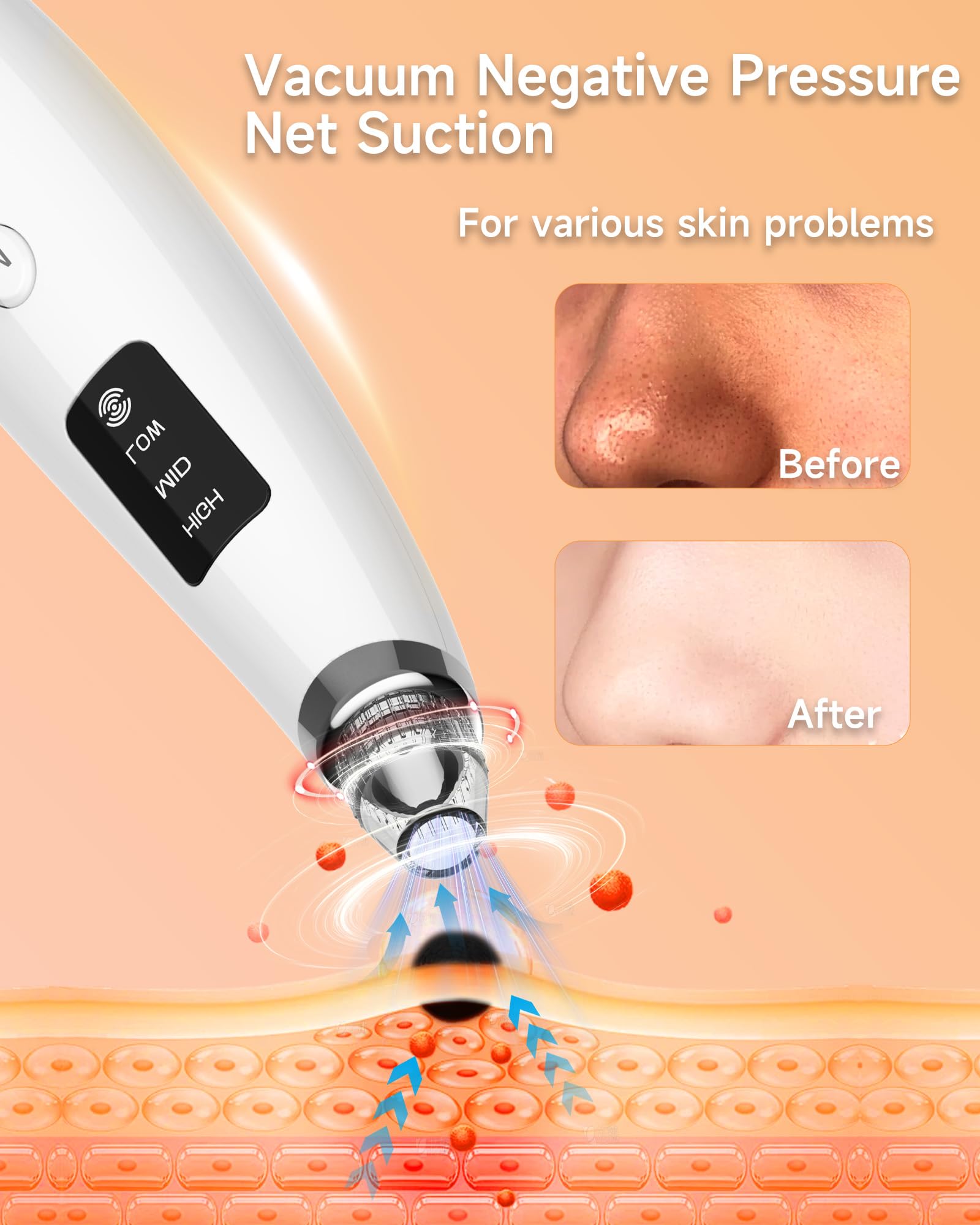 miley closeup of suction head illustrating tip detail, clear benefit: precise extraction