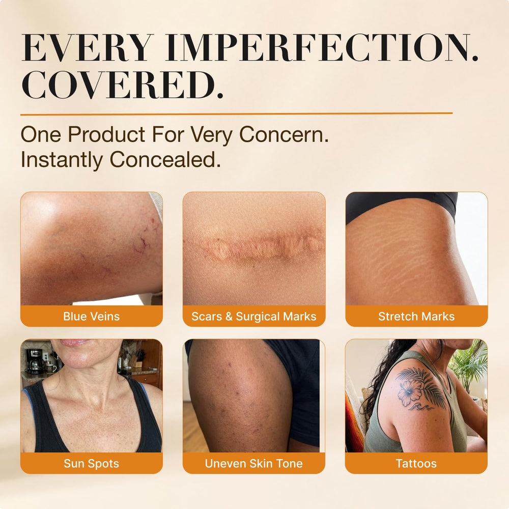 Miracle de Paris before and after leg image showing effective coverage results