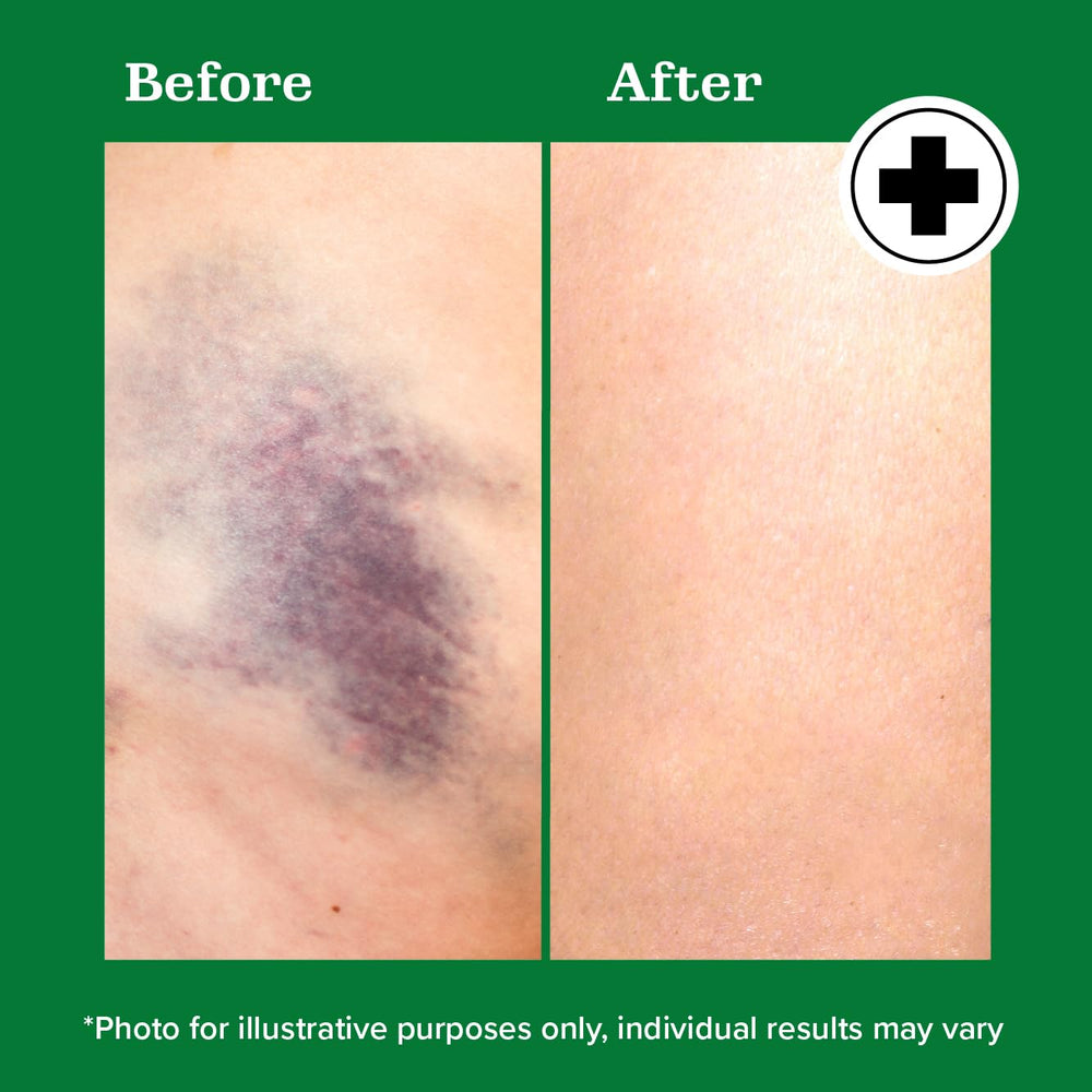 Before and after concept with Miracle Plus illustrating improved skin appearance