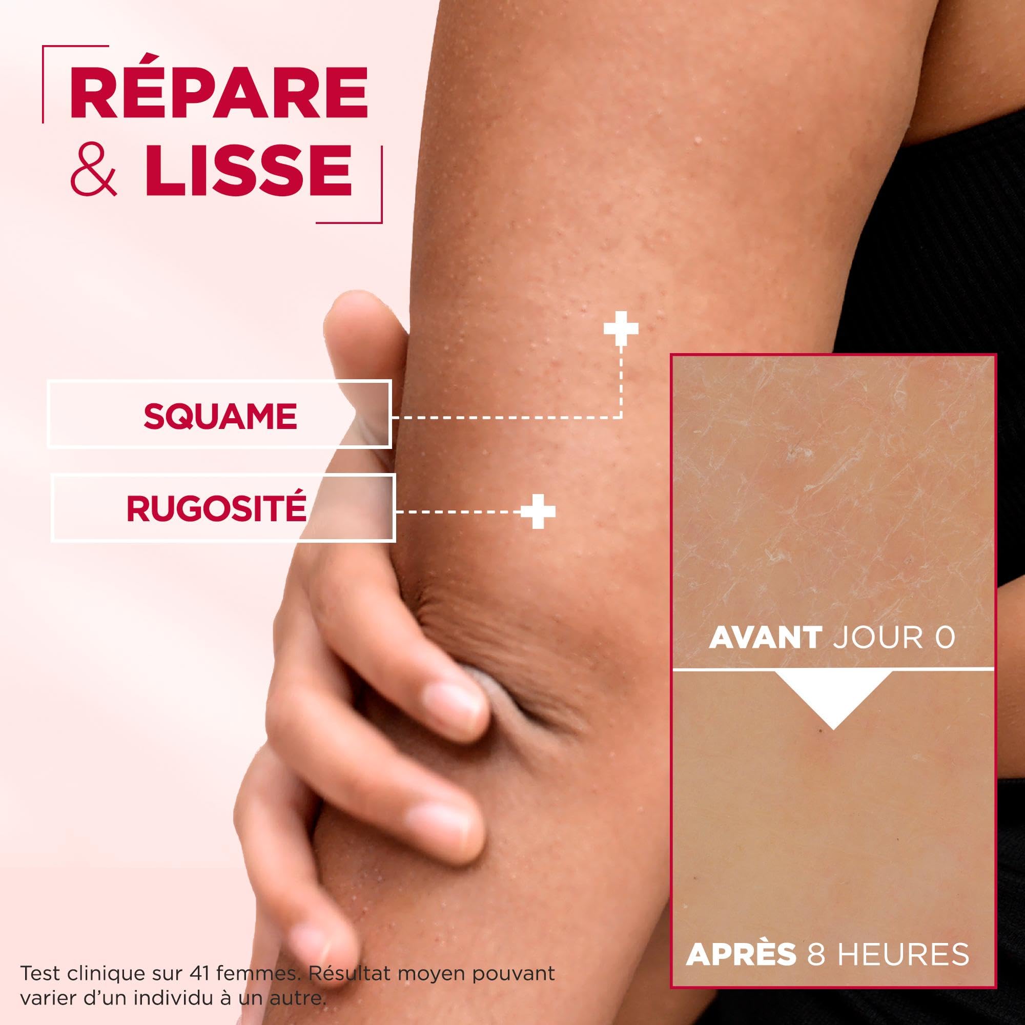 Mixa ingredients label close-up showing urea and niacinamide benefits