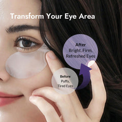 MIZON open jar displaying hydrogel patches ready to nourish skin