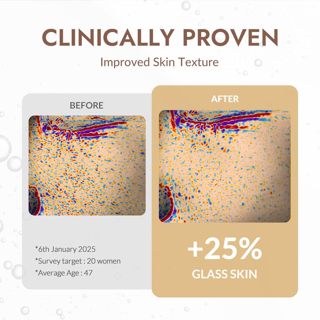 MIZON ampoule before and after skin texture visual, smoother-looking skin benefit