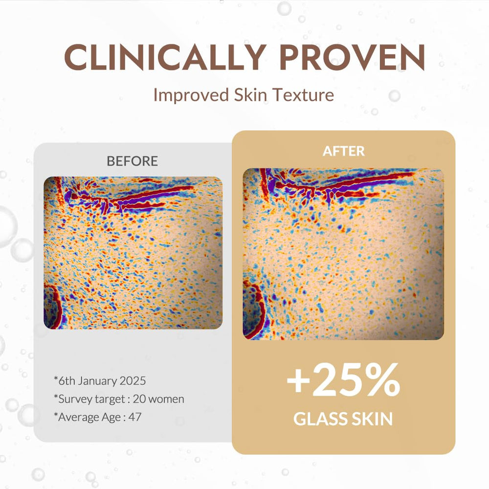 MIZON ampoule before and after skin texture visual, smoother-looking skin benefit