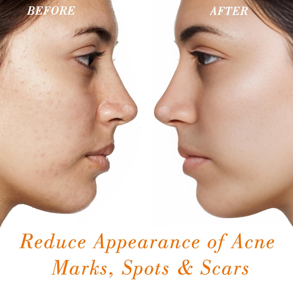MMPANG oil texture on skin demonstrating fast absorption benefit
