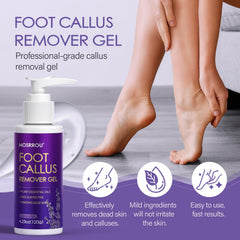 MOSRROU callus remover closeup showing dual-sided precision for smoother feet