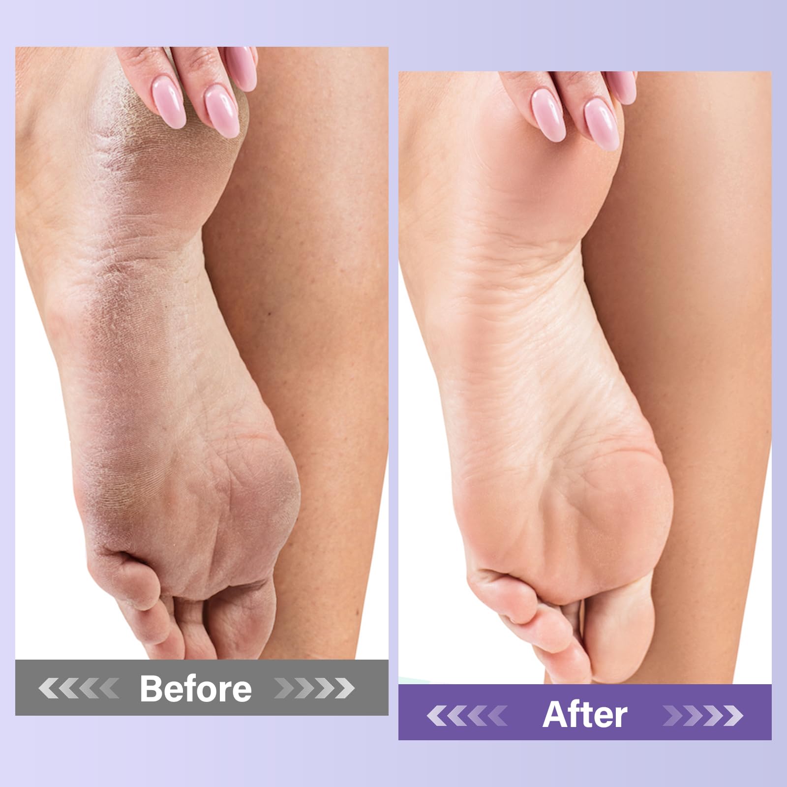MOSRROU feet in warm soak demonstrating relaxation and softened calluses