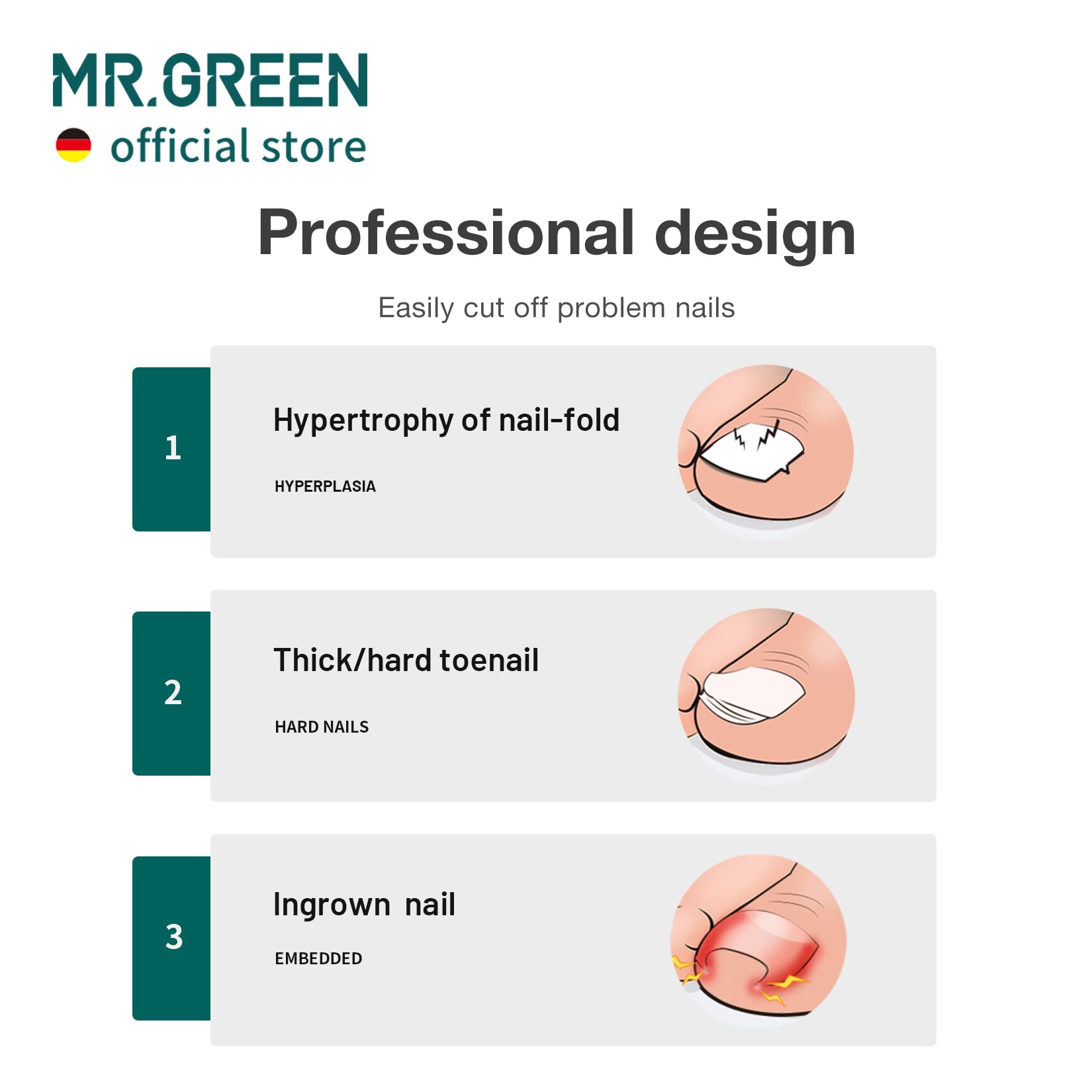MR.GREEN handle texture detail displaying anti-slip plated finish for secure grip