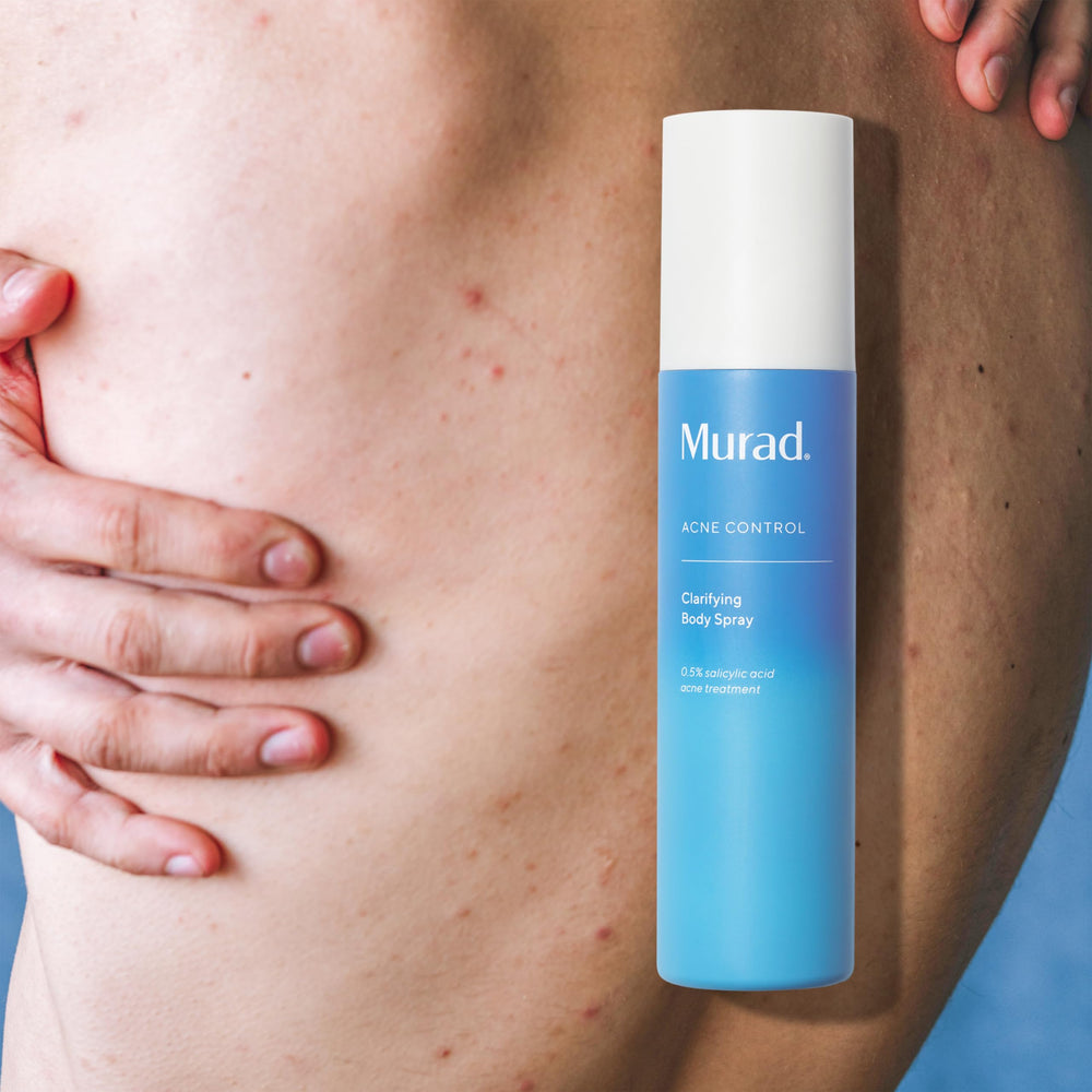 Murad spray being applied to a person’s upper back for treatment