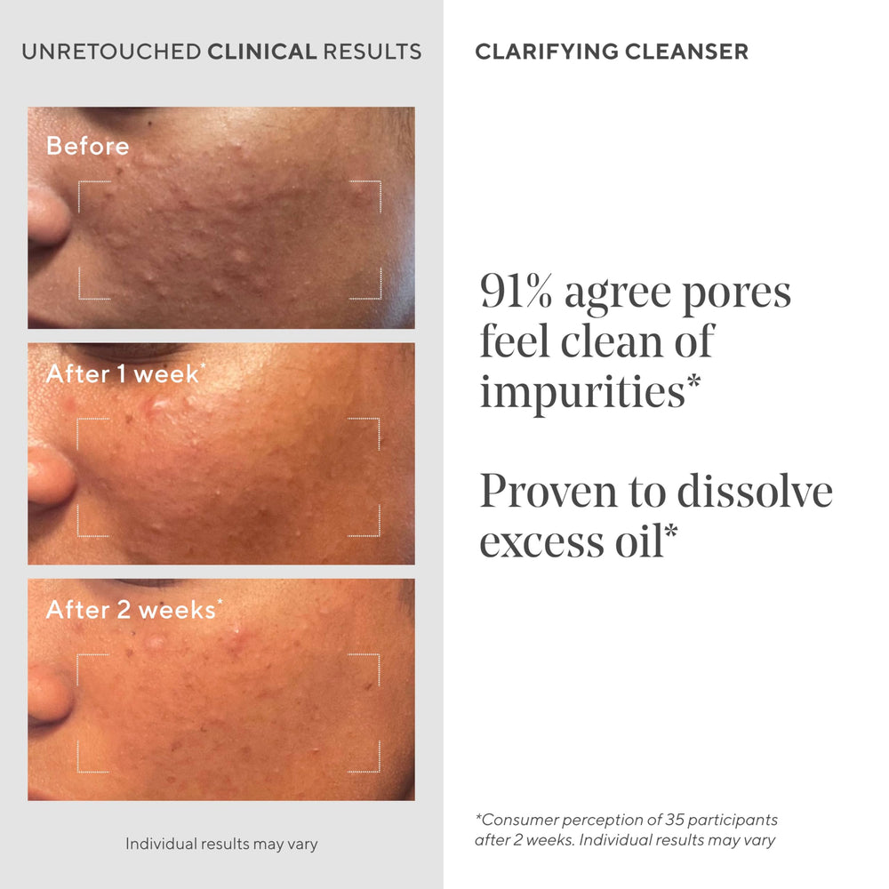 Close-up of Murad ingredient label highlighting salicylic acid benefit
