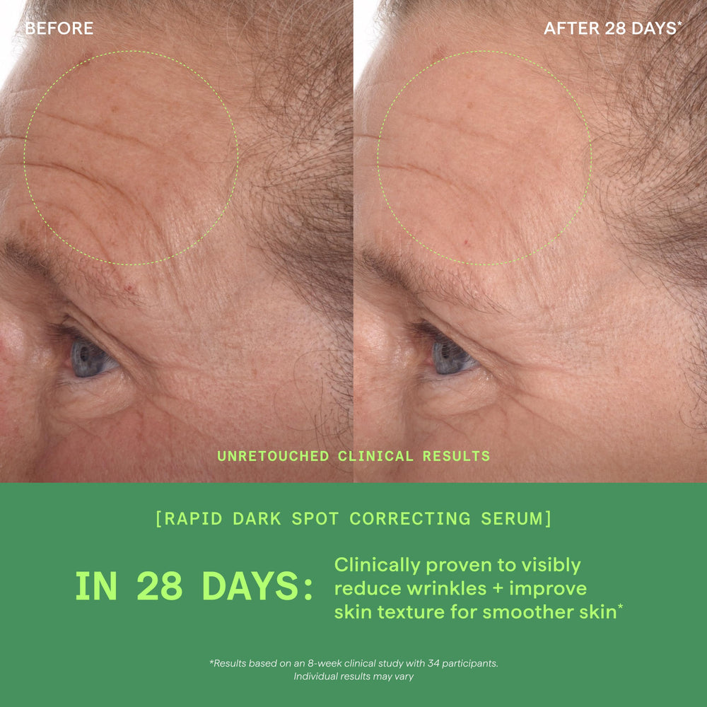 Murad ingredients graphic showing glycolic and tranexamic acids benefit